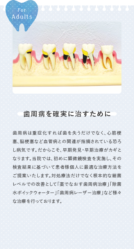 歯周病を確実に治すために
