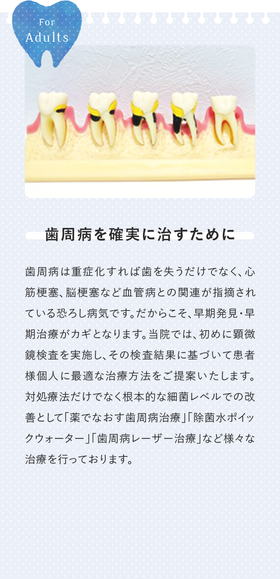 歯周病を確実に治すために