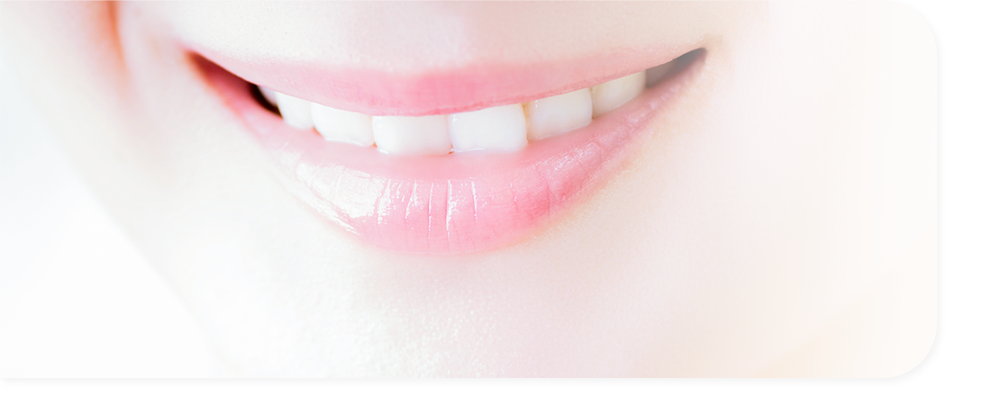 ダイレクトボンディング