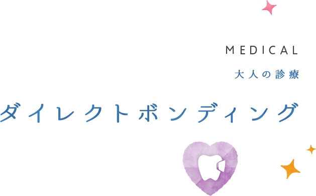 ダイレクトボンディング