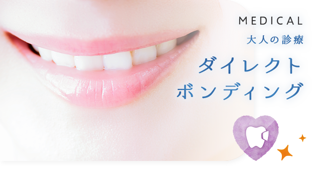 ダイレクトボンディング