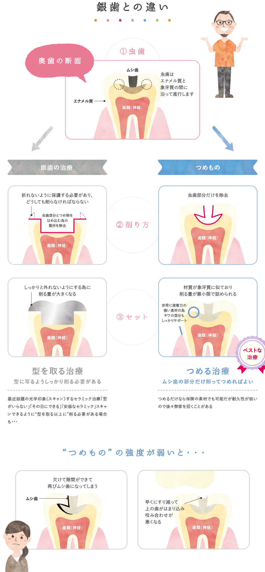 銀歯との違い