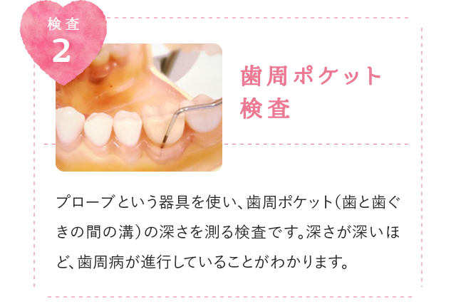 歯周ポケット検査