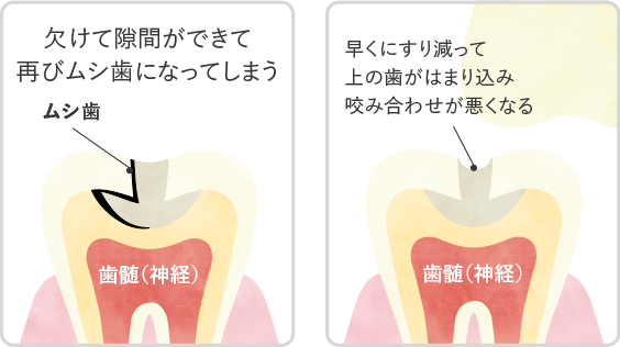 つめものの強度が弱いと