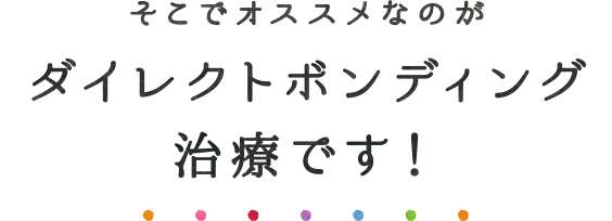 ダイレクトボンディング