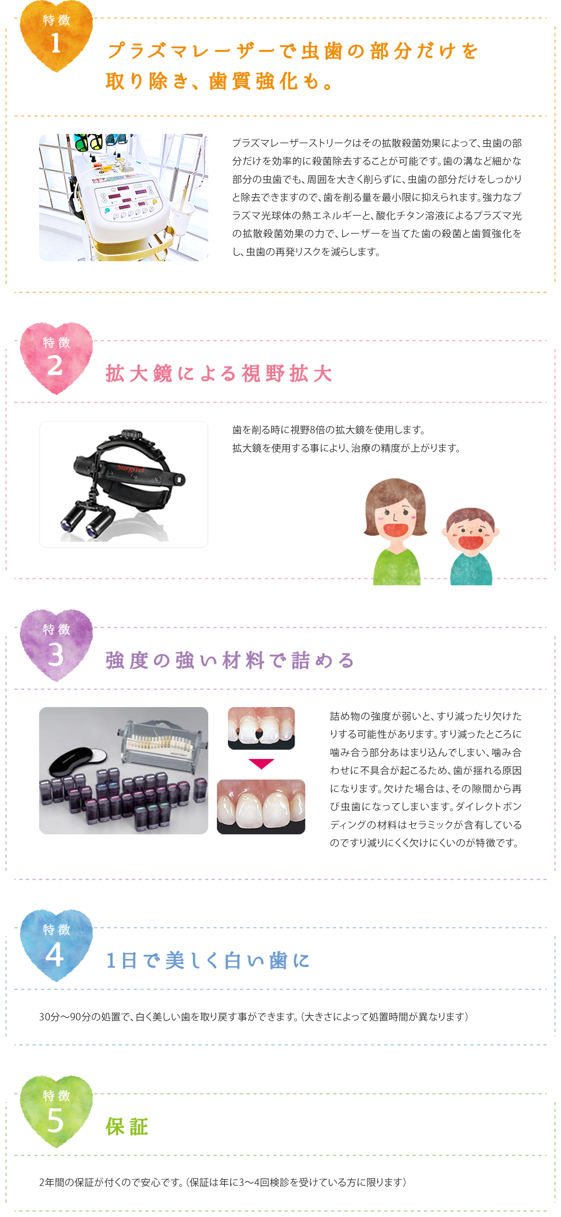 ダイレクトボンディング特徴